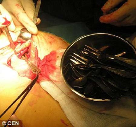 เรื่องแปลก